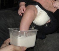 Baby_foot_casting