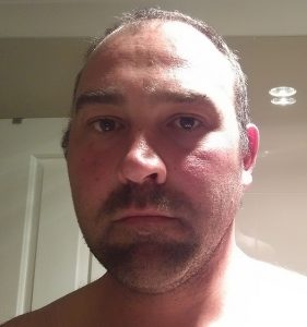 series-7000-vacuum-beard-trimmer