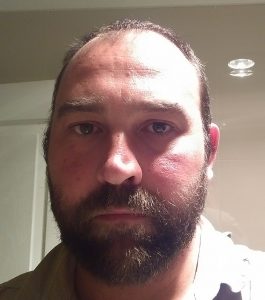 series-7000-vacuum-beard-trimmer-review