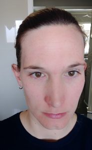 homedics-microdermabrasion-review