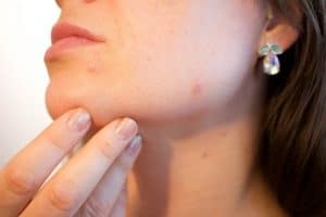 womens-skincare