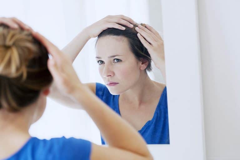 female-hair-loss