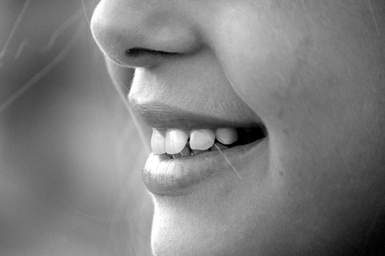 What Parents Need to Know About Invisalign for Kids