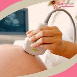 pregnant belly being scanned via ultrasound