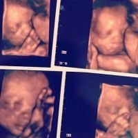 Newborn 3D image