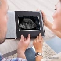 Mum and Dad looking at their baby's 3D image