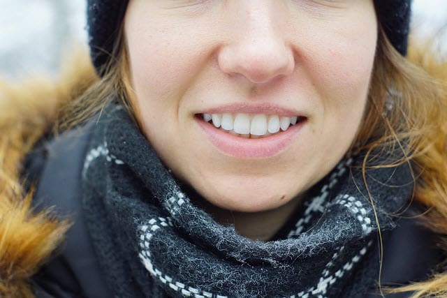 Close-up of smiling womans teeth