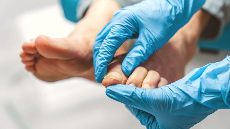 Do I Need A Referral To See A Podiatrist In Brisbane