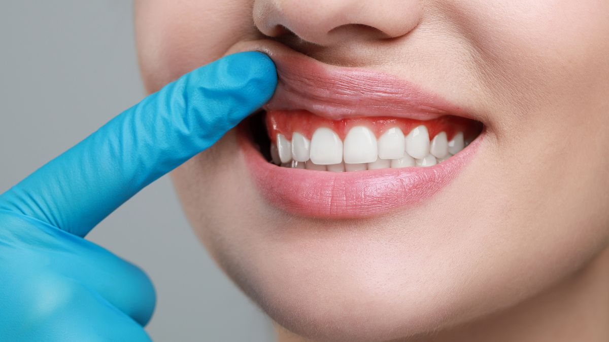 Why Gum Health Deserves Just As Much Attention As Your Teeth